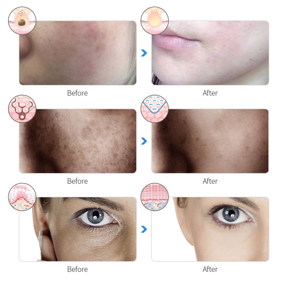 GLOSIFLY™-LED Face Mask